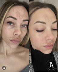 Anita Cosmetics Salon — munkafotó 3