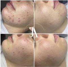 Anita Cosmetics Salon — munkafotó 5