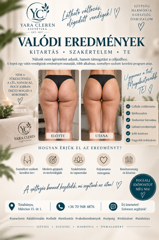 Yara Cleren Esztétika — munkafotó 6