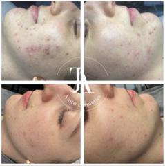 Anita Cosmetics Salon — munkafotó 4