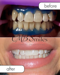 CMBsmiles — portfolio photo 4