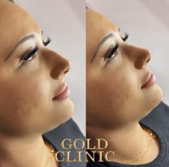 Gold Clinic — portfolio photo 4