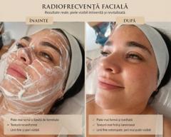 Beauty Divine By RC-Epilare definitivă & Remodelare corporală — fotografie din portofoliu 10