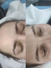 Cosmetica faciala — fotografie din portofoliu 7