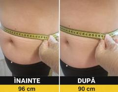 Beauty Divine By RC-Epilare definitivă & Remodelare corporală — fotografie din portofoliu 3