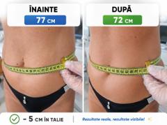 Beauty Divine By RC-Epilare definitivă & Remodelare corporală — fotografie din portofoliu 2