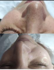 Cosmetica faciala — fotografie din portofoliu 5
