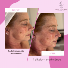Renewal of the beauty — munkafotó 14