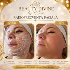 Beauty Divine By RC-Epilare definitivă & Remodelare corporală — fotografie din portofoliu 6