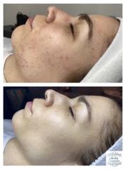 Anita Cosmetics Salon — munkafotó 6