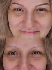 Perfect Brows ByEmilly Love — fotografie din portofoliu 15