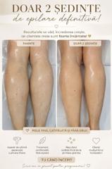 Beauty Divine By RC-Epilare definitivă & Remodelare corporală — fotografie din portofoliu 11