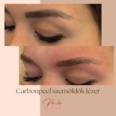 RenkoBeauty&Laser — munkafotó 3