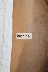 Beauty Divine By RC-Epilare definitivă & Remodelare corporală — fotografie din portofoliu 13