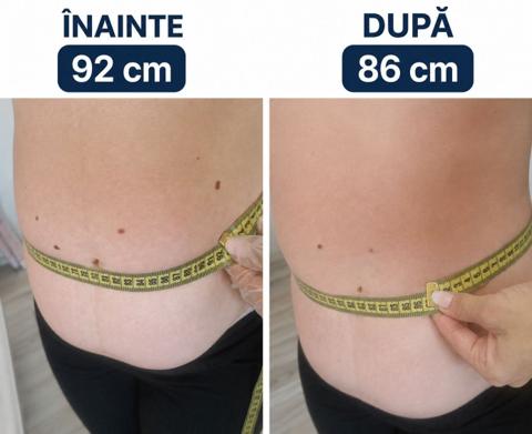 Beauty Divine By RC-Epilare definitivă & Remodelare corporală — fotografie din portofoliu 1
