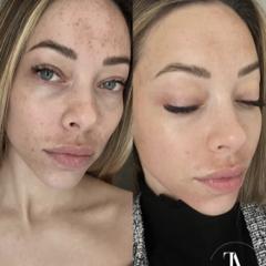Anita Cosmetics Salon — munkafotó 3