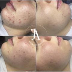 Anita Cosmetics Salon — munkafotó 5