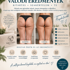 Yara Cleren Esztétika — munkafotó 6
