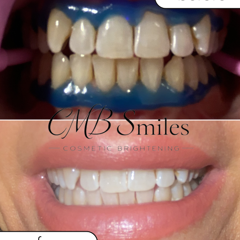 CMBsmiles — portfolio photo 4