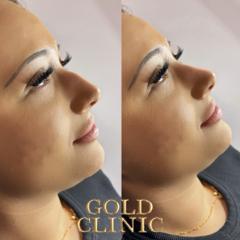 Gold Clinic — portfolio photo 4