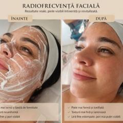 Beauty Divine By RC-Epilare definitivă & Remodelare corporală — fotografie din portofoliu 10
