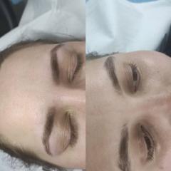 Cosmetica faciala — fotografie din portofoliu 7