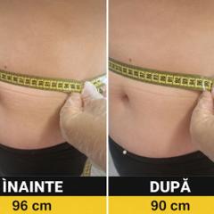 Beauty Divine By RC-Epilare definitivă & Remodelare corporală — fotografie din portofoliu 3