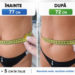 Beauty Divine By RC-Epilare definitivă & Remodelare corporală — fotografie din portofoliu 2