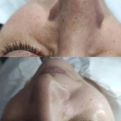 Cosmetica faciala — fotografie din portofoliu 5