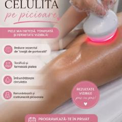 Beauty Divine By RC-Epilare definitivă & Remodelare corporală — fotografie din portofoliu 9