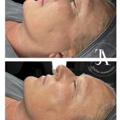 Anita Cosmetics Salon — munkafotó 7