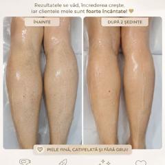 Beauty Divine By RC-Epilare definitivă & Remodelare corporală — fotografie din portofoliu 11