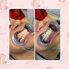 Prettywhite.teeth — portfolio photo 5