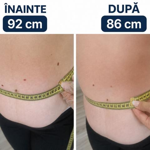 Beauty Divine By RC-Epilare definitivă & Remodelare corporală — fotografie din portofoliu 1