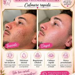 Cosmetica faciala — fotografie din portofoliu 2